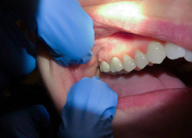 Best Emergency Denture Repair in Vidalia, GA