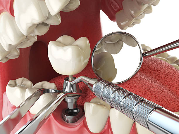 Best Emergency Gum Treatment in Vidalia, GA